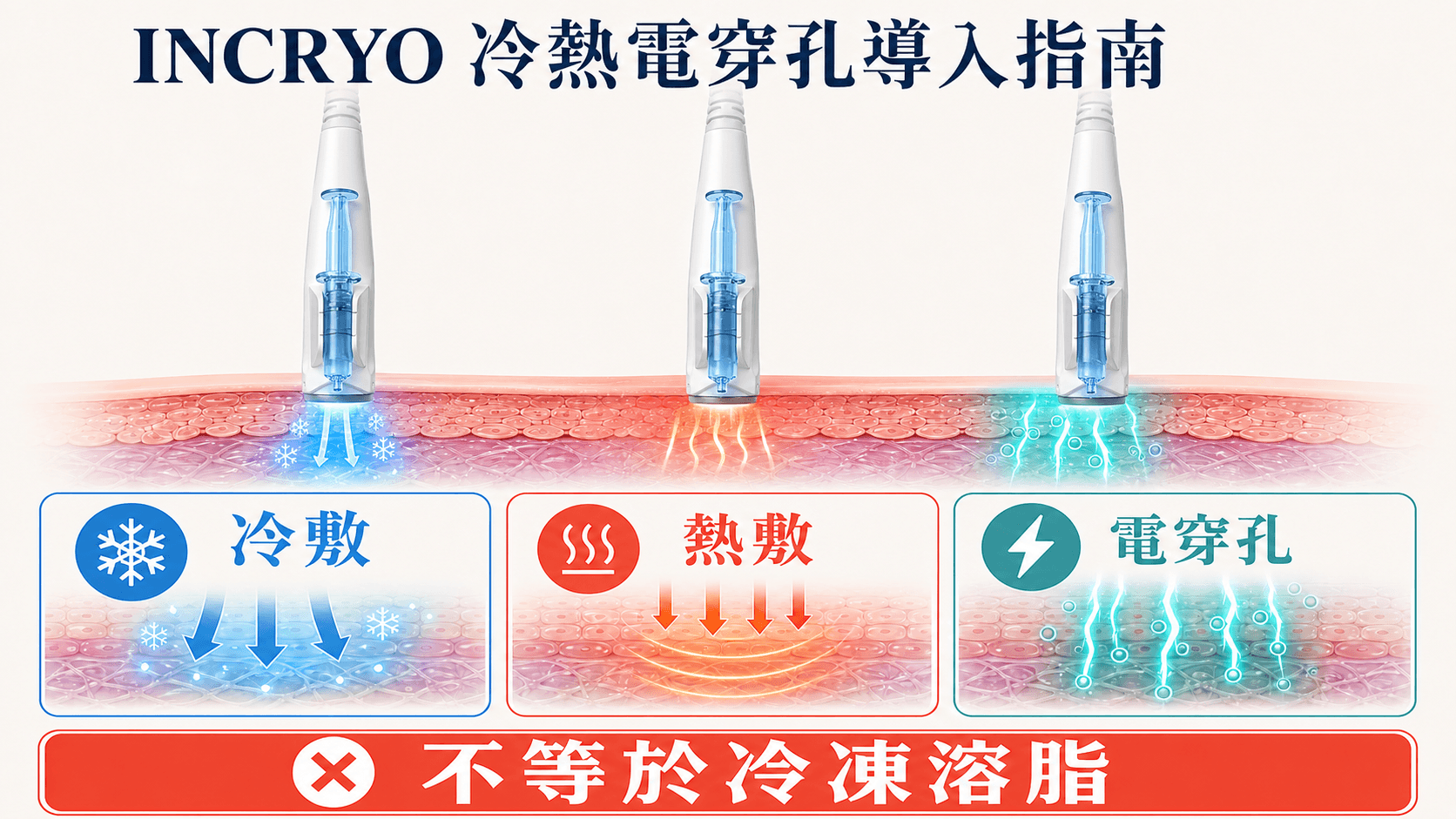 INCRYO冷熱電穿孔導入美容儀買機指南|原理、成本及與冷凍溶脂分別
