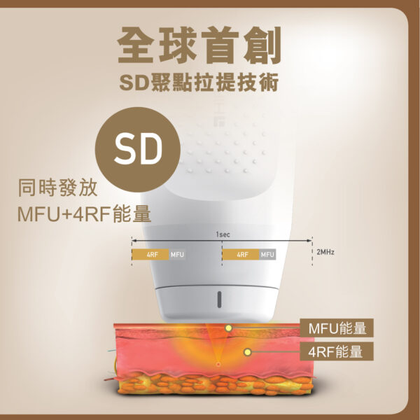 New Doublo SD微雕拉提 SD聚點拉提技術 MFU 4RF 完美視覺 精雕細琢